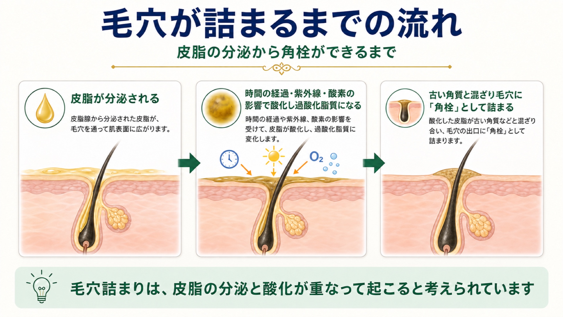 毛穴が詰まるまでの流れ