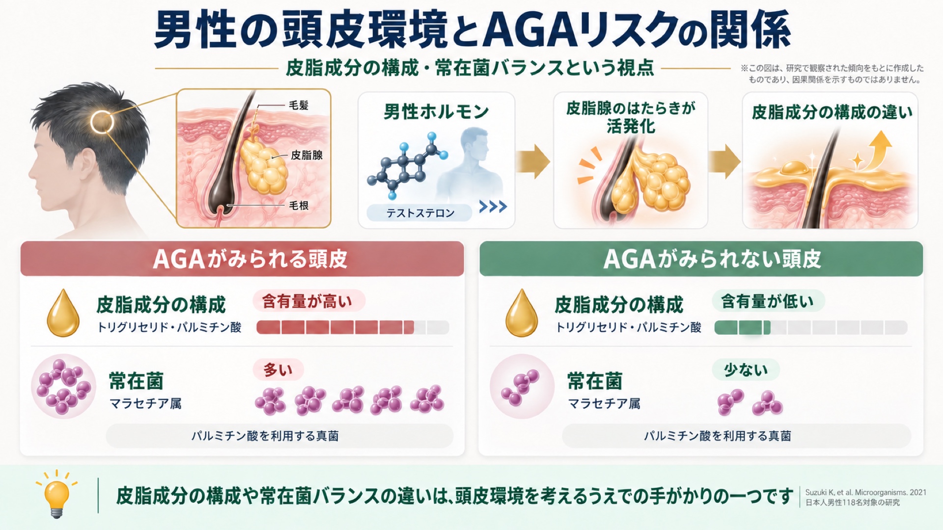 男性の頭皮環境とAGAリスクの関係