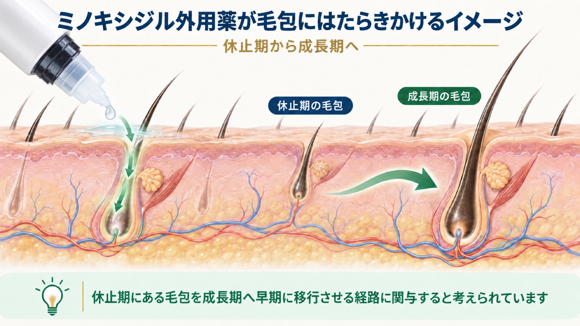 ミノキシジル外用薬が毛包にはたらきかけるイメージ