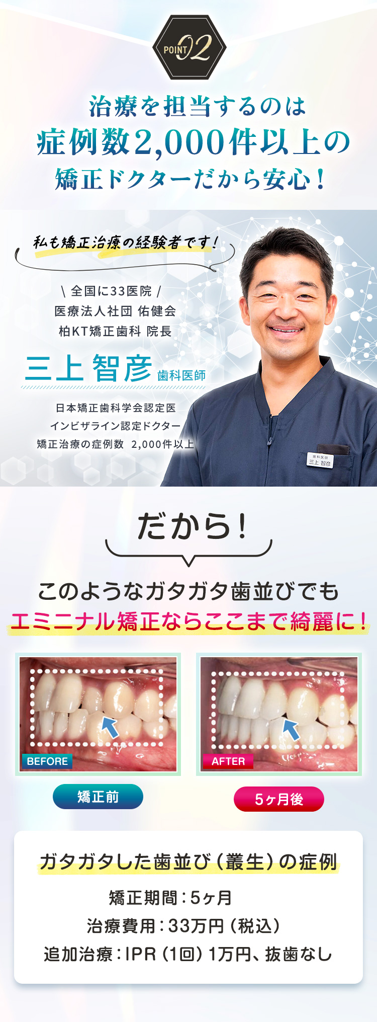 エミニナル矯正