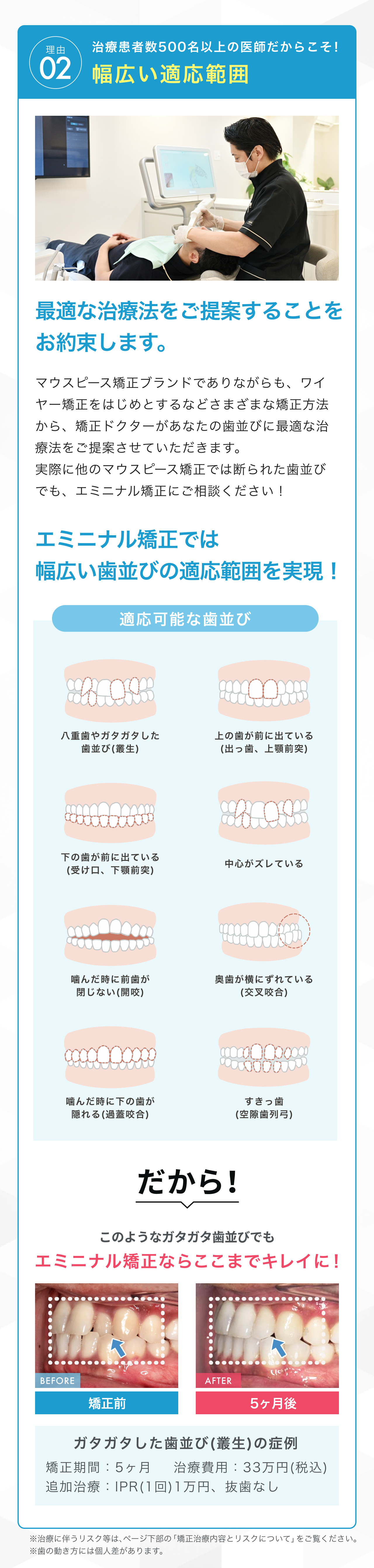 エミニナル矯正