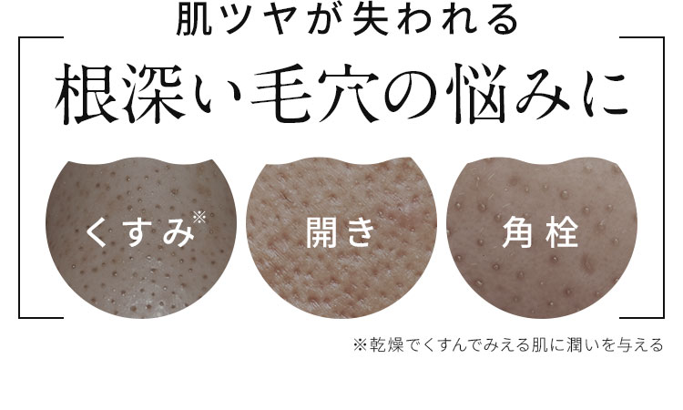 肌ツヤが失われる根深い絵穴の悩みに