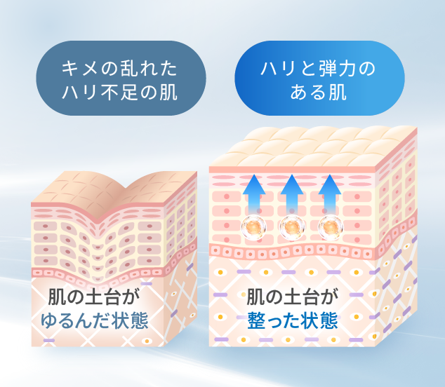 イラスト：「キメの乱れたハリ不足の肌」と「ハリと弾力のある肌の断面図」