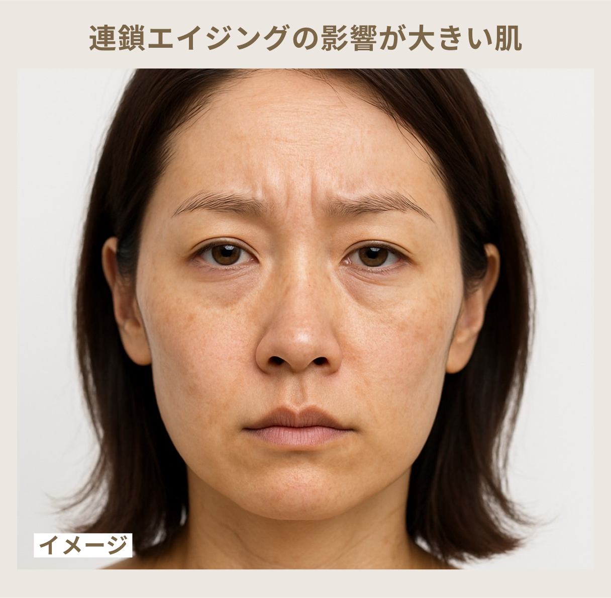 連鎖エイジングの影響が大きい肌