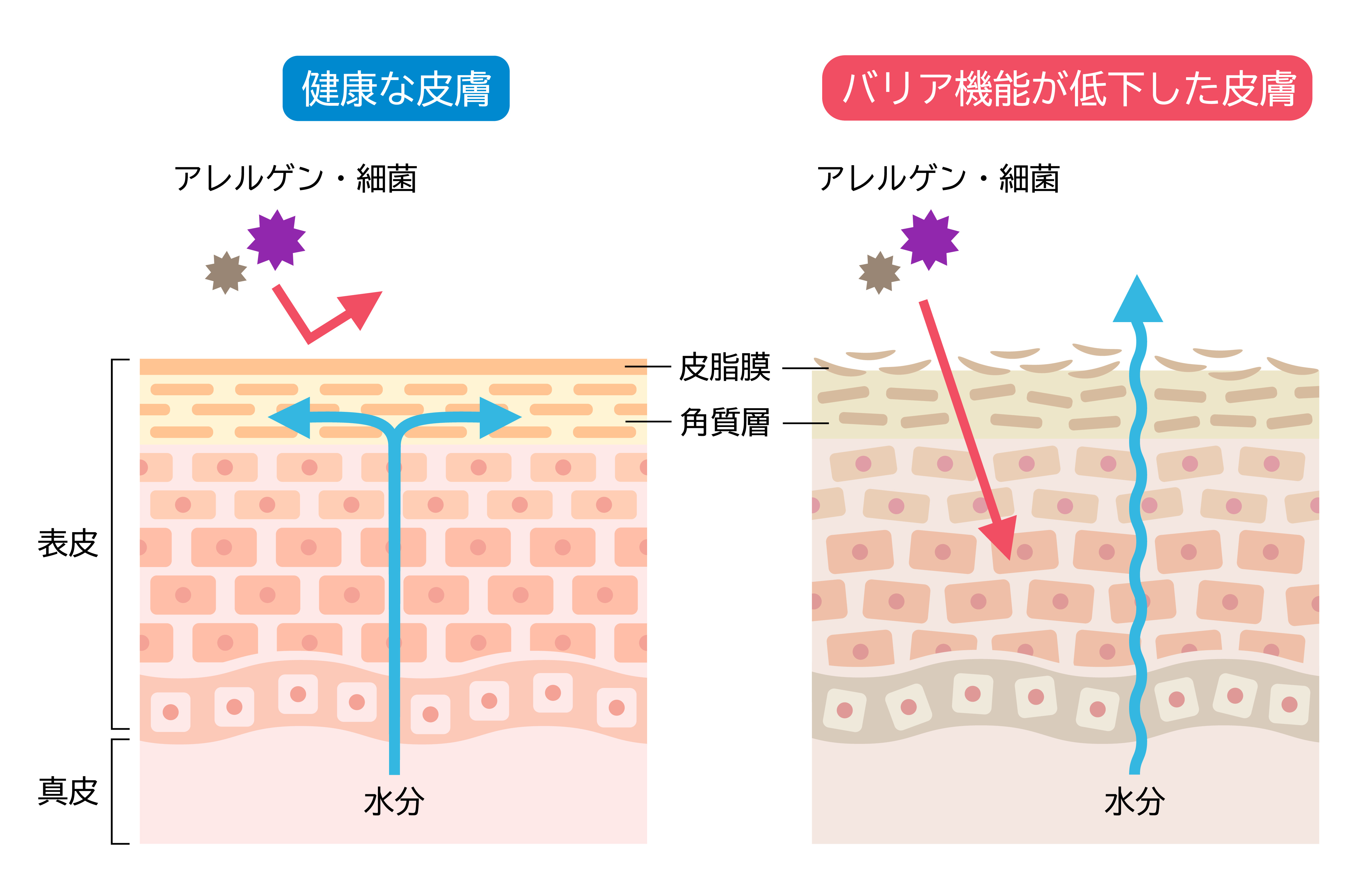 敏感肌のバリア機能とは？低下する原因を徹底解説