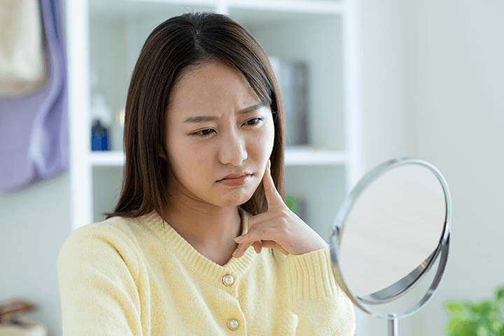 ニキビ等による顔の赤み