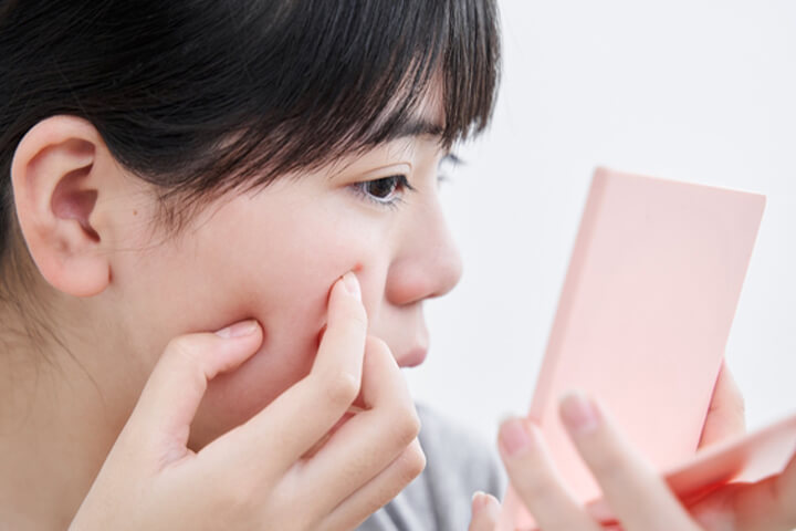 よくある質問：ゆらぎ肌のケアと対策について