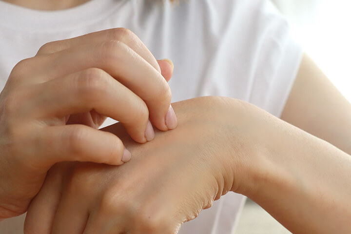 アトピー肌の特徴と保湿の必要性