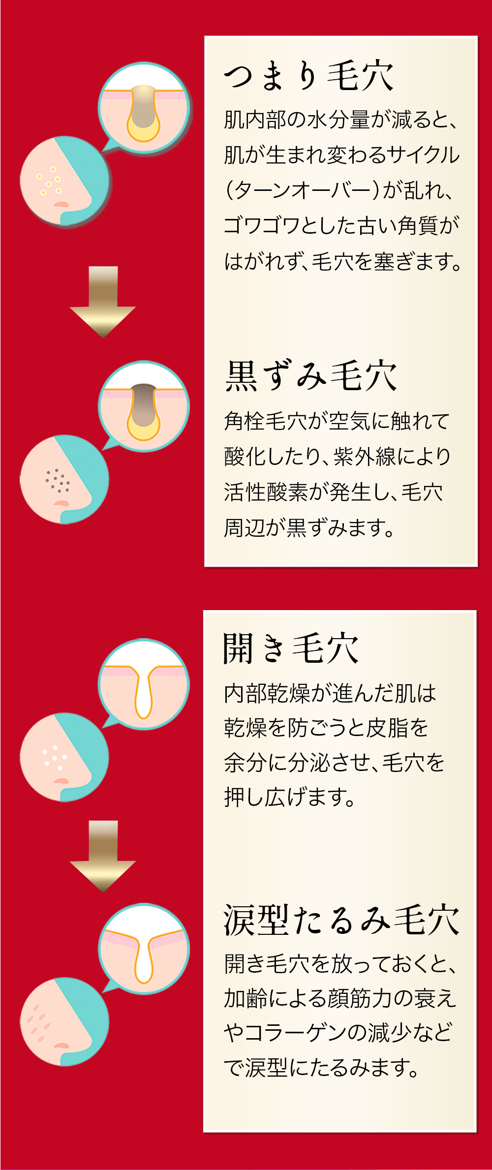 あなたの毛穴の悩みはインナードライが原因です