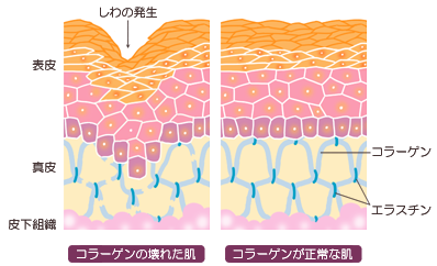 肌の構造の説明図