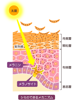 シミのできるメカニズムの説明図