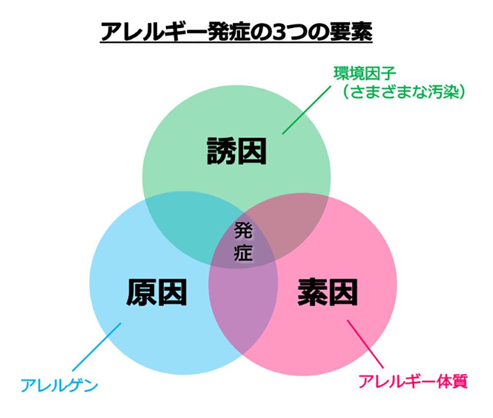 アレルギー発症の3要素（原因・素因・誘因）を示すベン図。アレルゲン、アレルギー体質、環境因子（さまざまな汚染）の重なりを解説。