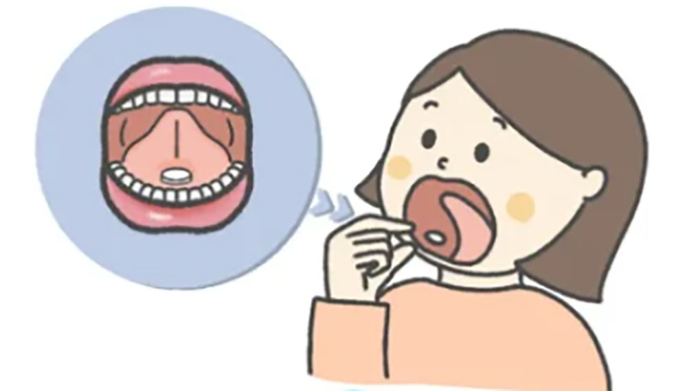 舌の下に薬を置いて投与する女性のイラスト。アレルギー体質を改善する舌下免疫療法のイメージ。