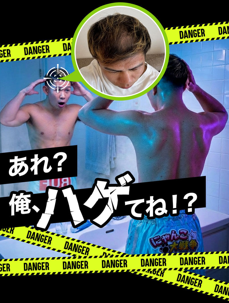 あれ？俺、ハゲてね！？