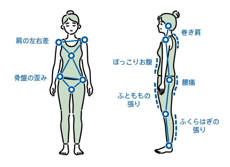 姿勢の崩れによる体の不調の図解（肩の左右差・骨盤の歪み・巻き肩・ぽっこりお腹・腰痛・ふともも/ふくらはぎの張り）