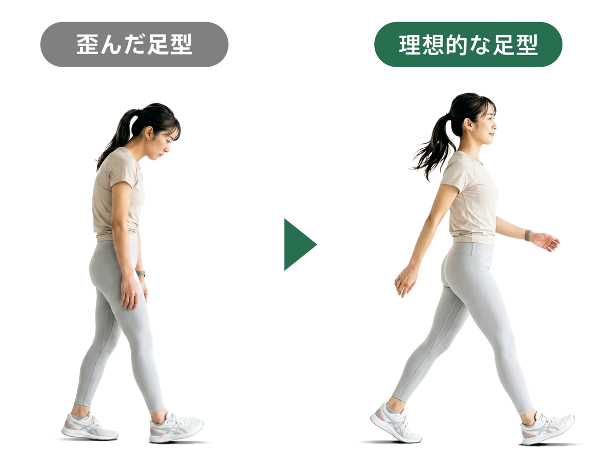 歪んだ足型（前方重心）と理想的な足型（かかと重心）の歩行姿勢の比較