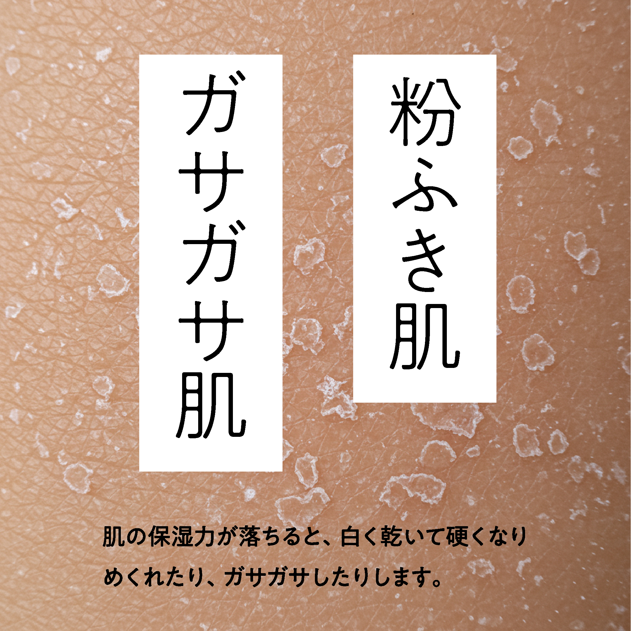 ホームメディックアルフィーネミルクジェル