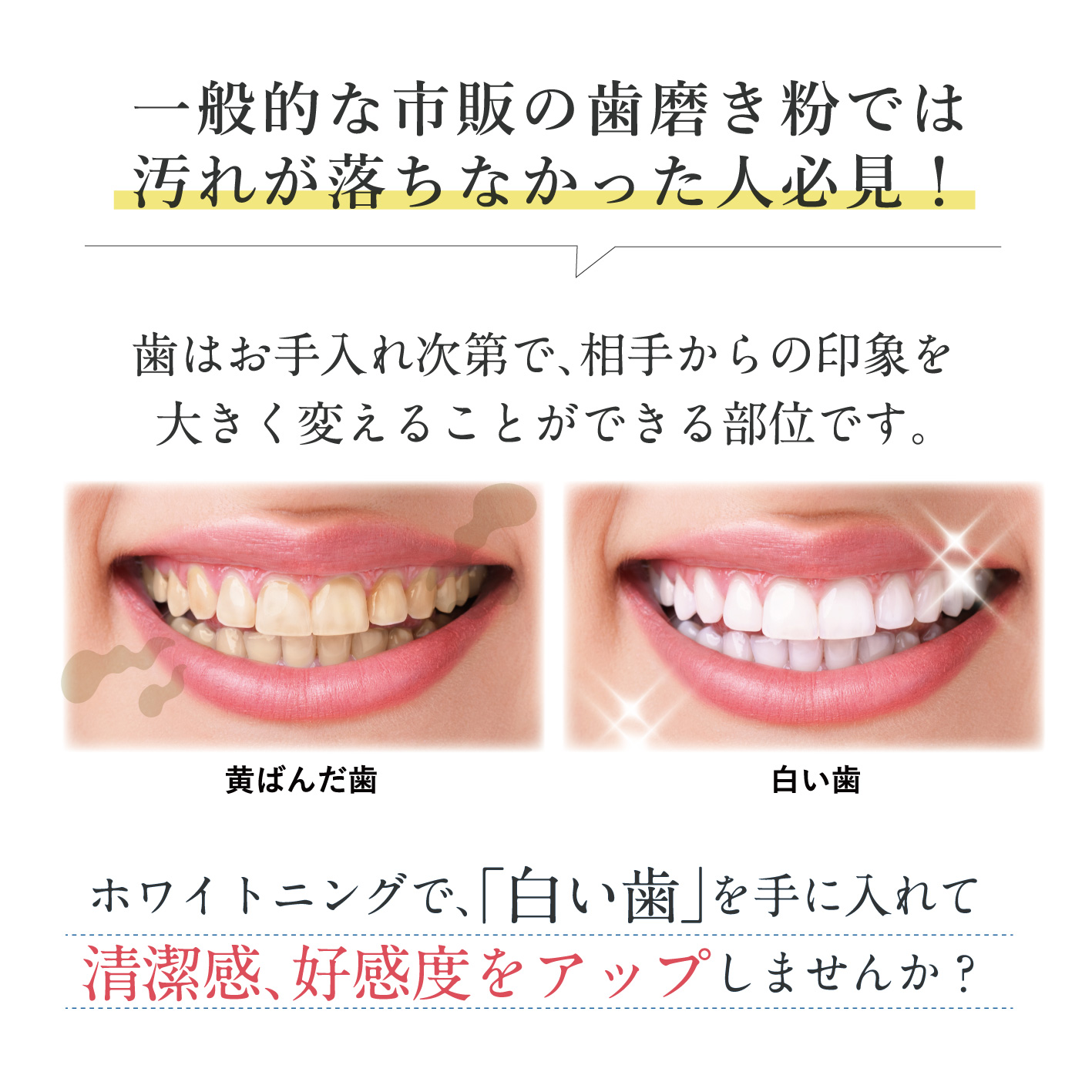 メディカルホワイトプロ　タッチペン /: 1本