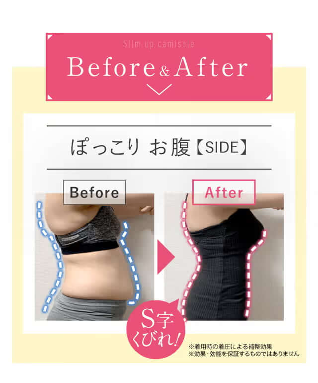 Before&After｜ぽっこり お腹【SIDE】S字くびれ！