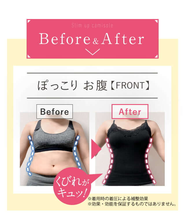 Before&After｜ぽっこり お腹【FRONT】くびれがキュッ！