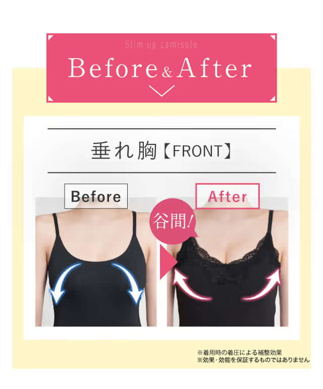 Before&After｜垂れ胸【FRONT】谷間！