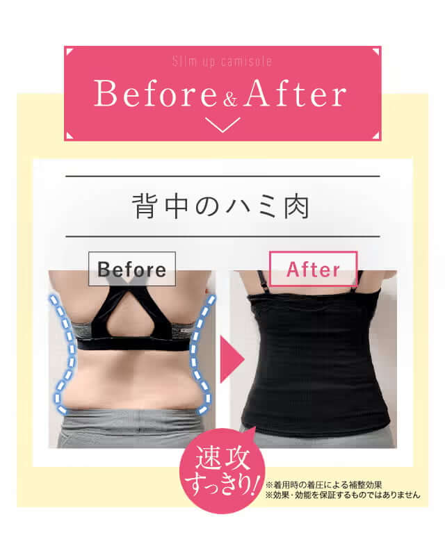 Before&After｜背中のハミ肉 速攻すっきり！