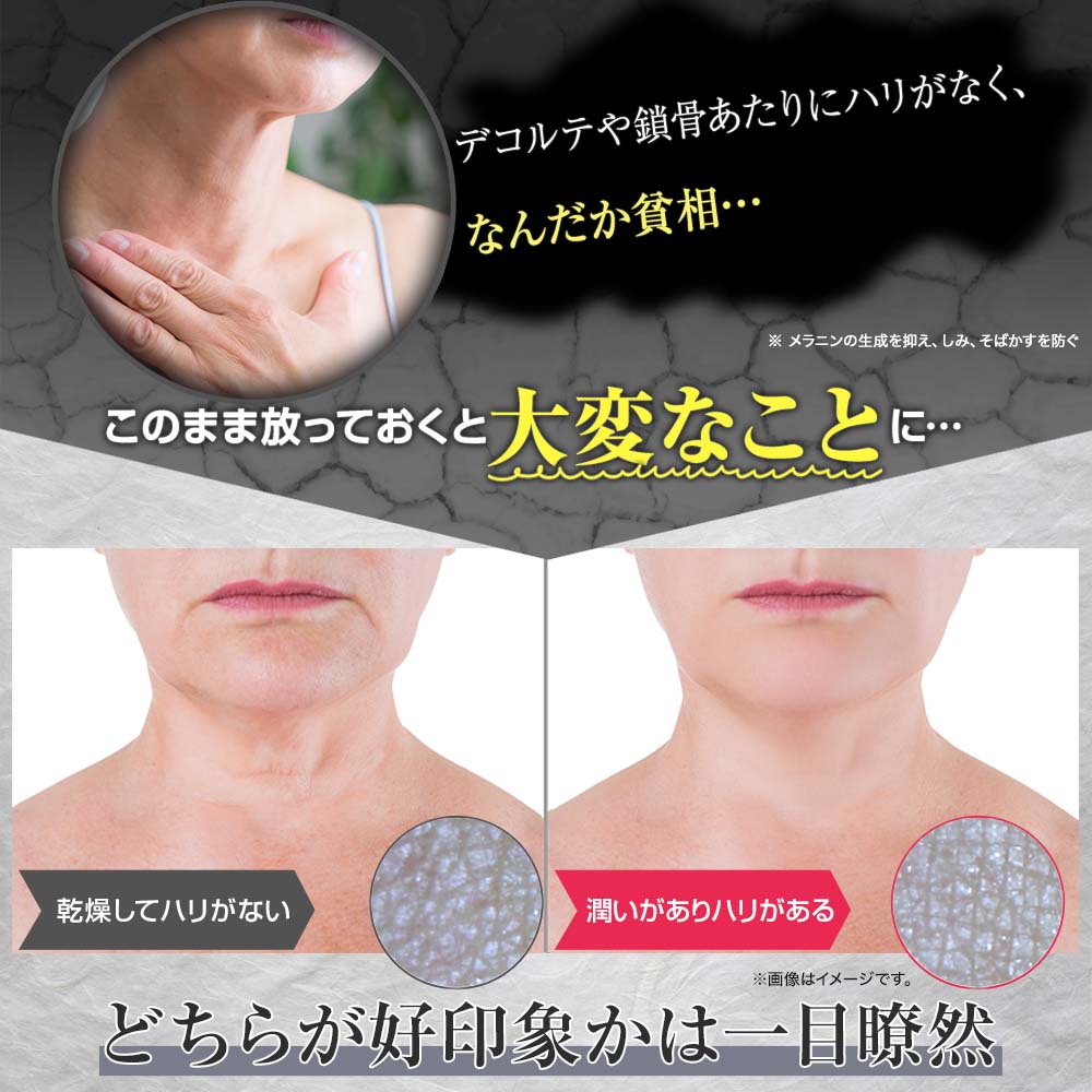 ラップリフトネック 50g