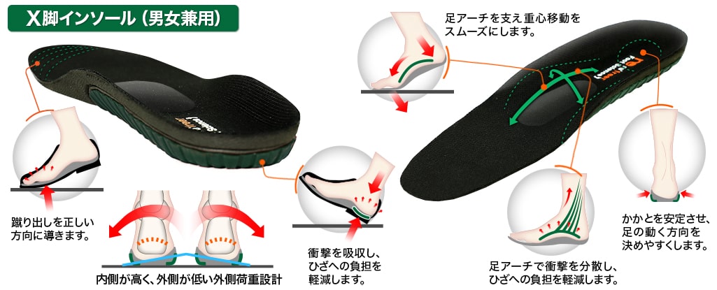 X脚インソール