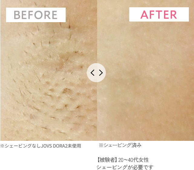 BEFORE・AFTER（4週間使用）