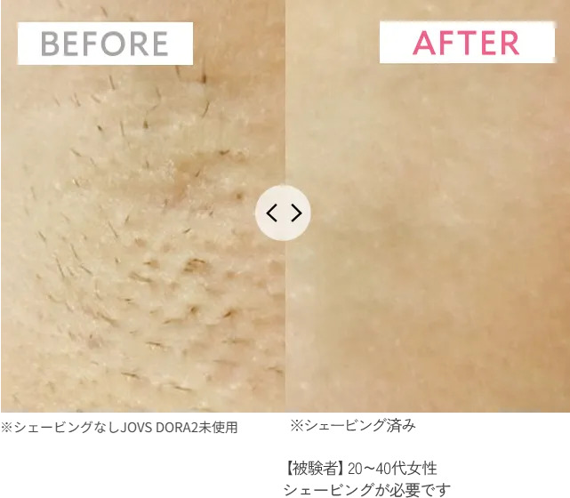 BEFORE・AFTER（4週間使用）
