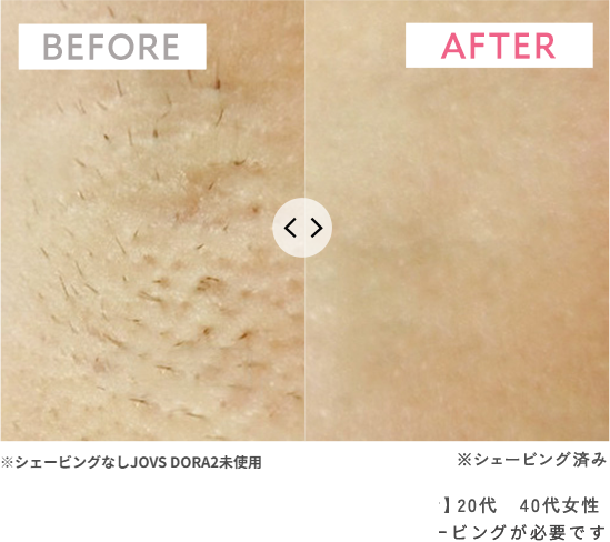 before/after