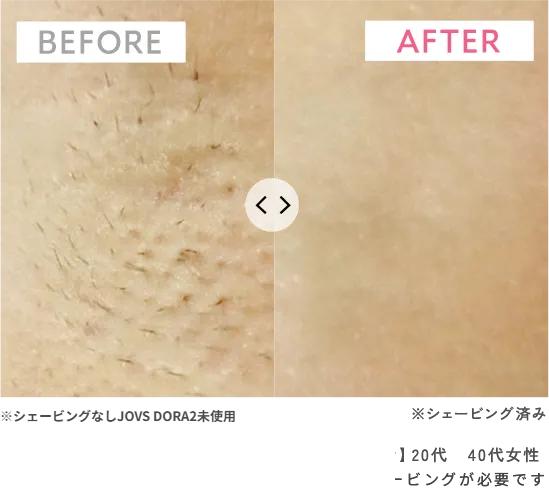 before/after