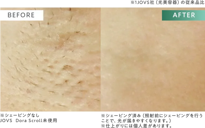 BEFORE / AFTER