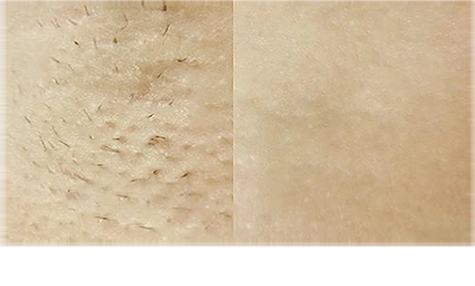 BEFORE / AFTER