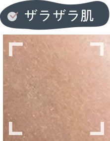 ザラザラ肌