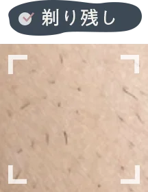 剃り残し