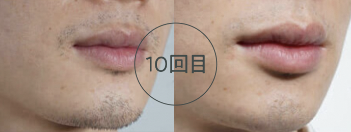 10回目（ヒゲ）