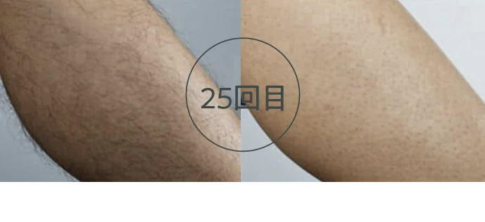 25回目（足）