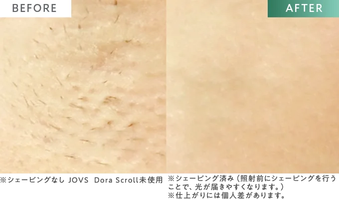 BEFORE / AFTER