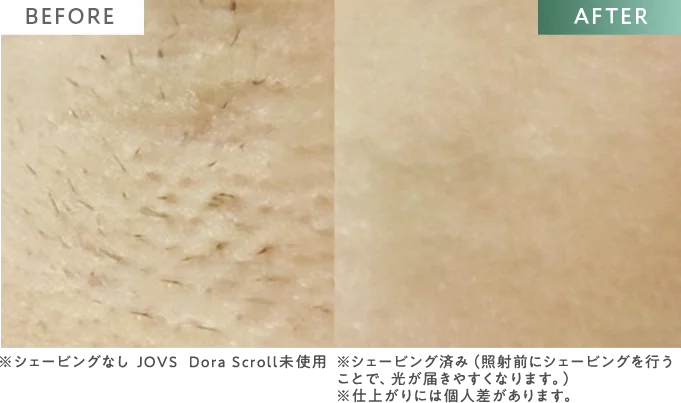 BEFORE / AFTER