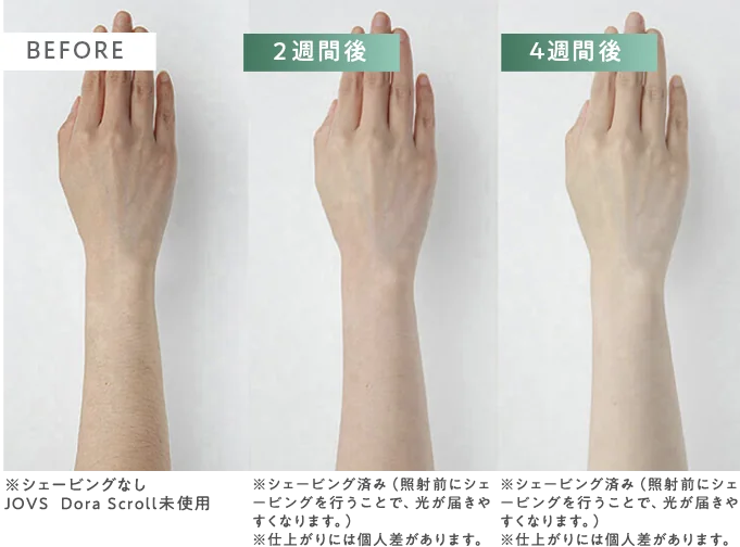 BEFORE / AFTER