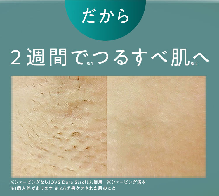 だから2週間でつるすべ肌へ