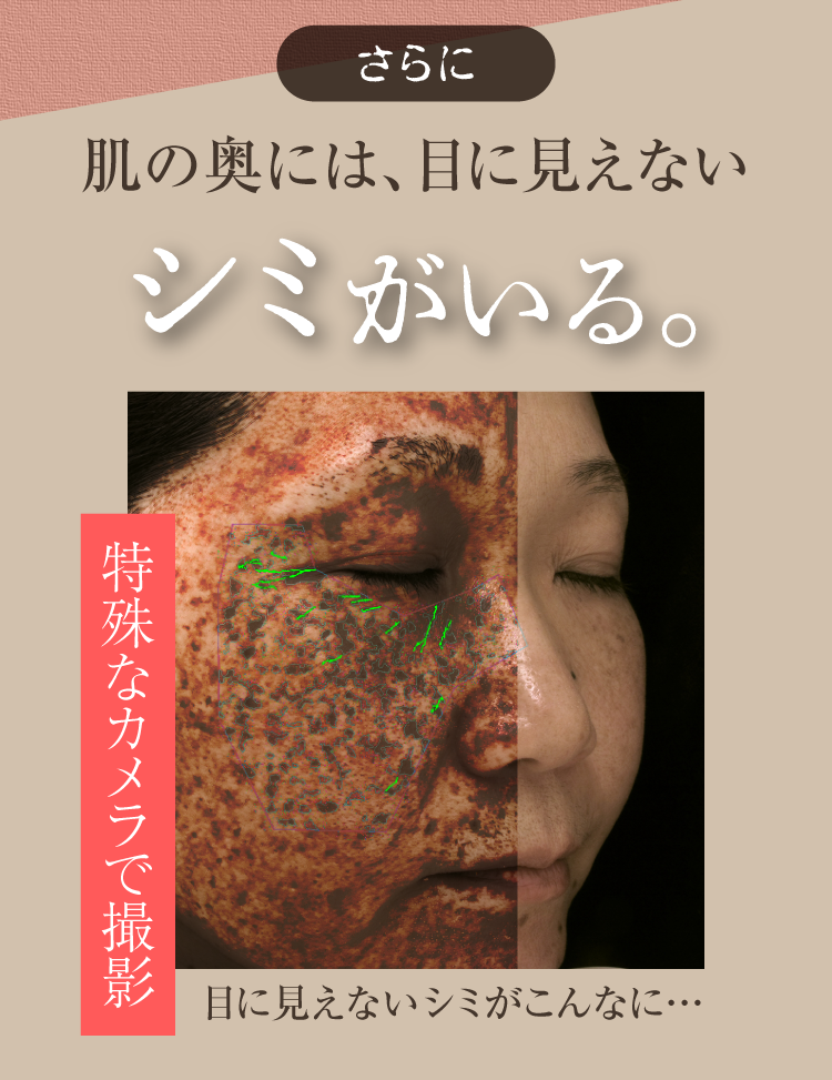 さらに肌の奥には、目に見えないシミがいる