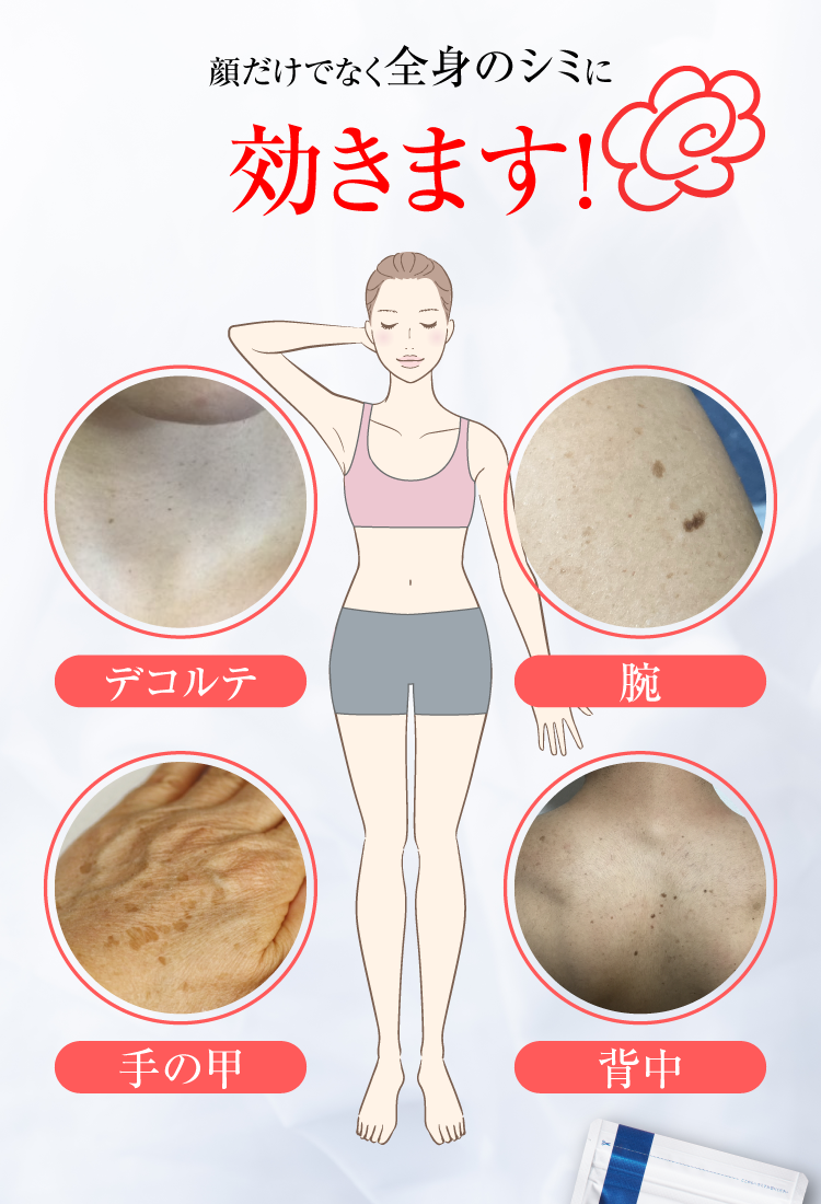 顔だけでなく全身のシミに効きます！