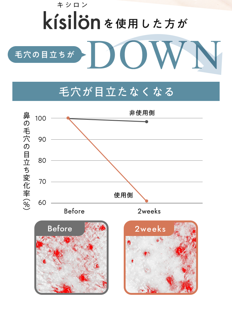 毛穴が目立たなくなる