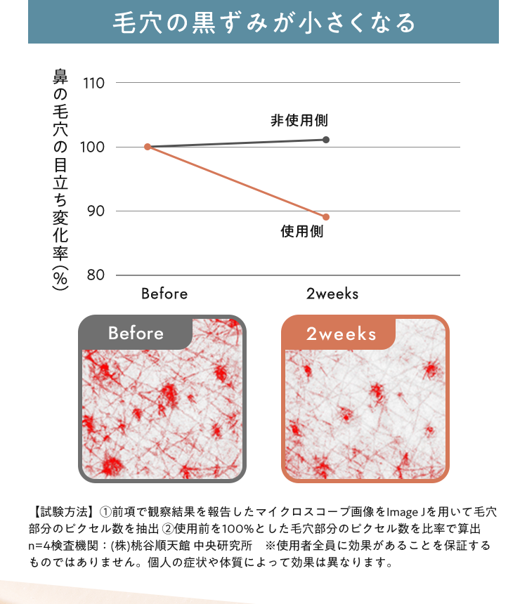 毛穴の黒ずみが小さくなる