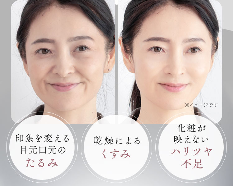 印象を変える目元口元のたるみ
