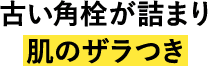 古い角栓が詰まり肌のザラつき