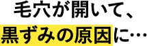 毛穴が開いて、黒ずみの原因に…