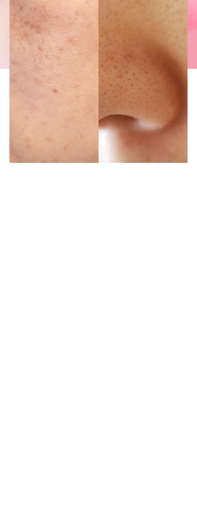 くすみの原因さようなら